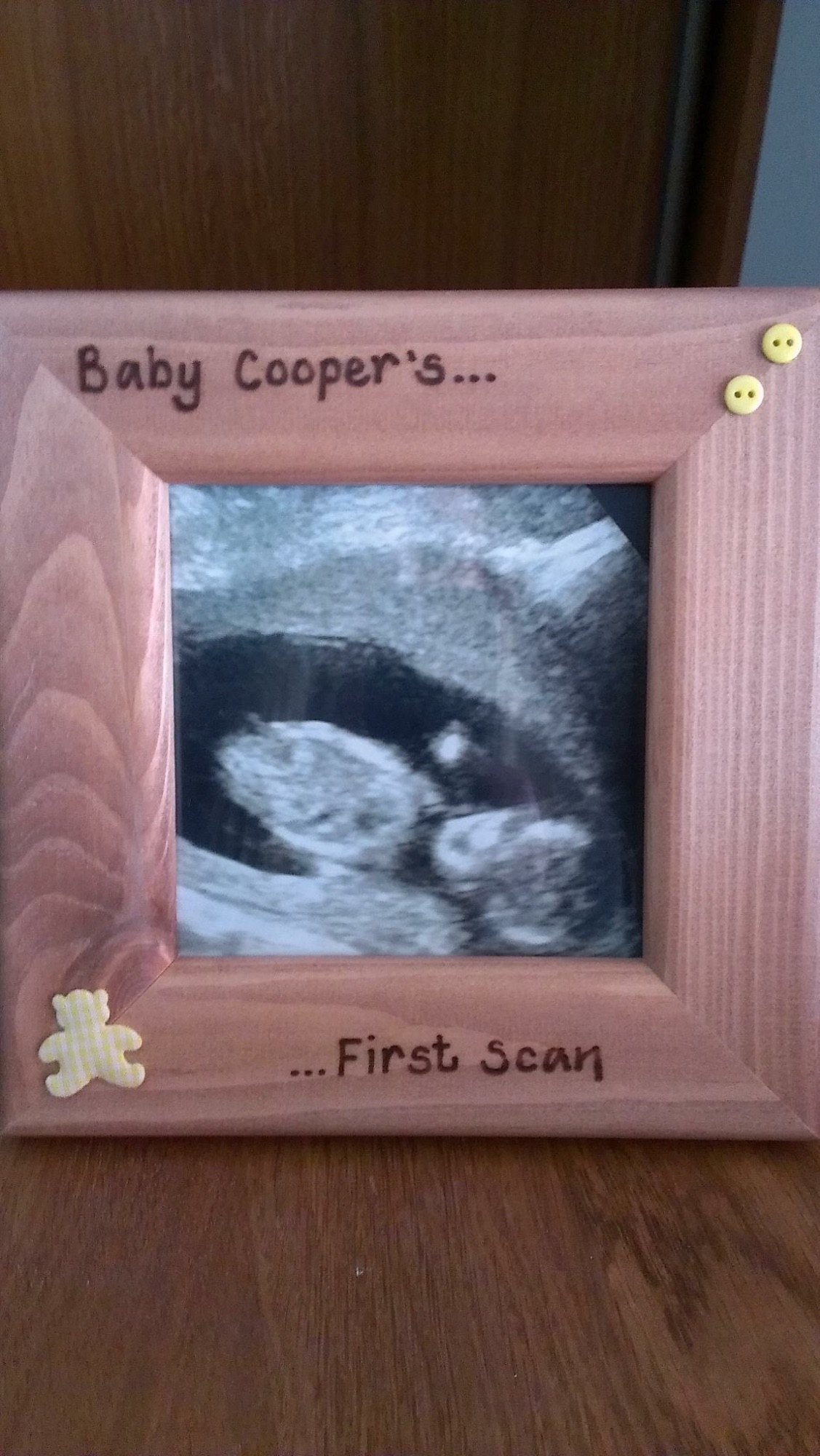 baby scan photo frame