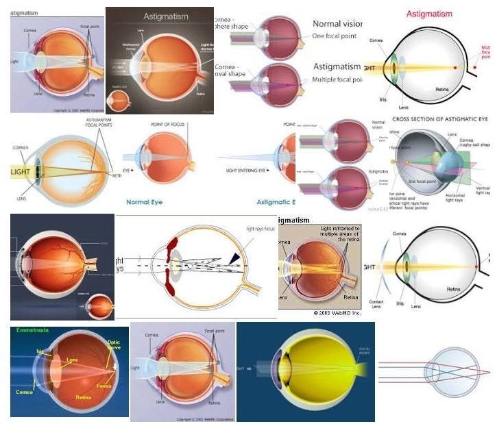 astigmatism diagram