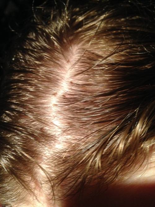 What do head lice look like