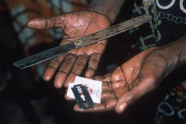 FGM-instruments