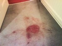 Blood Stain - swanseacarpetcleaning.co.uk