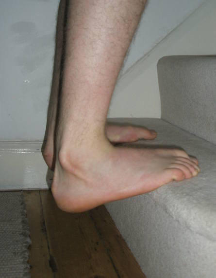 Ankle Stair