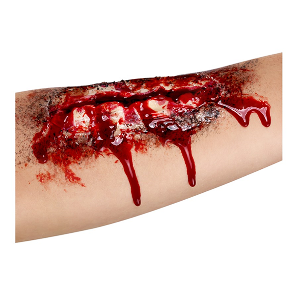Open Wound Latex Scar