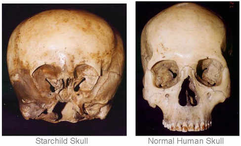 Human Skull