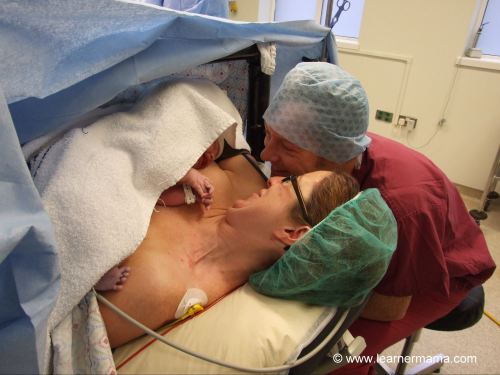 caesarean hypnobirthing