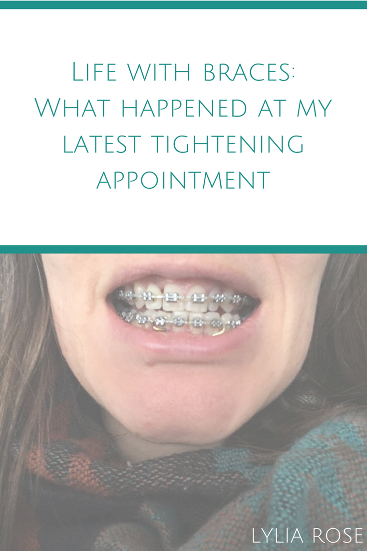 Life with orthodontic braces as an adult What happened at my latest