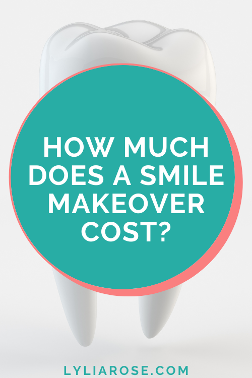 How much does a smile makeover cost