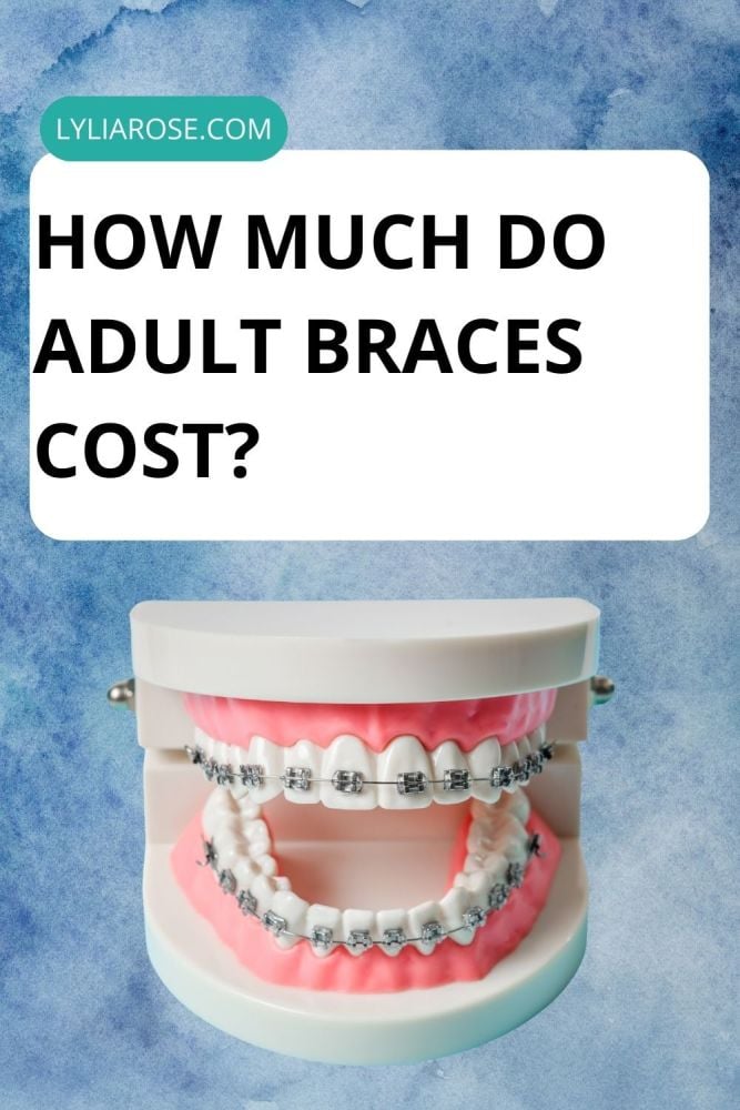 How much do adult braces cost