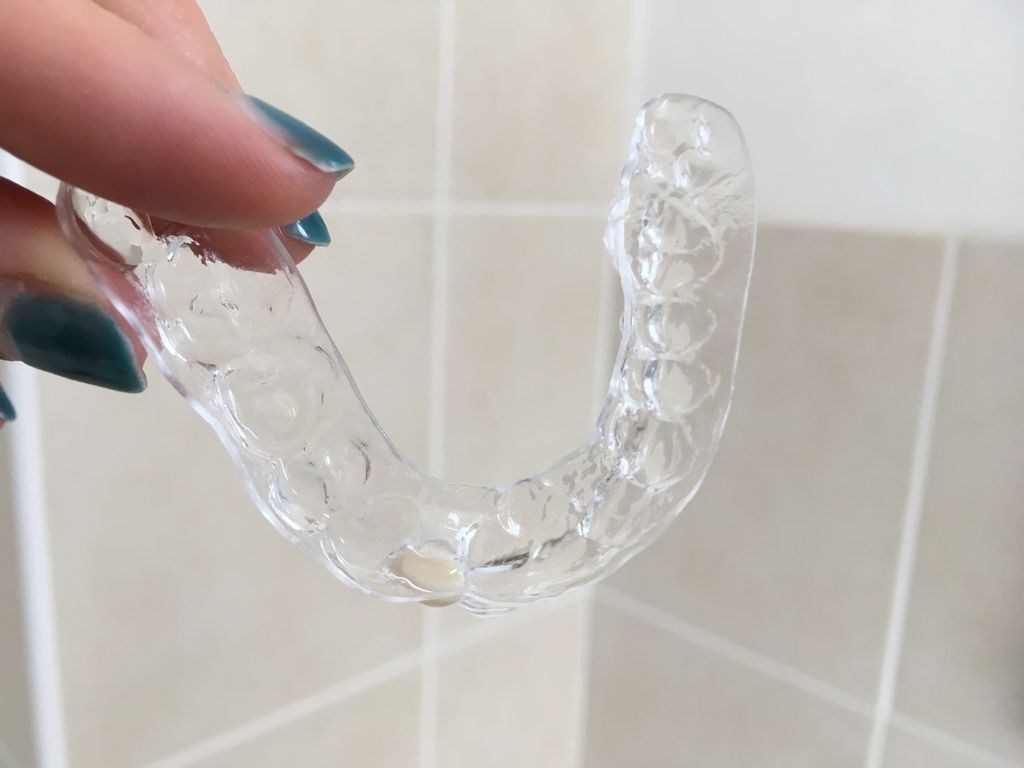 Essix retainer held up showing one false tooth