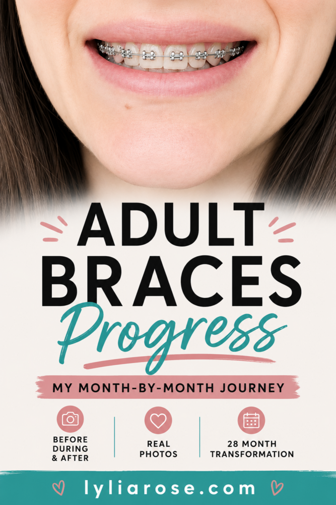 Adult Braces Progress My Month by Month Journey With Photos (1) Adult Braces Progress My Month by Month Journey With Photos (1)