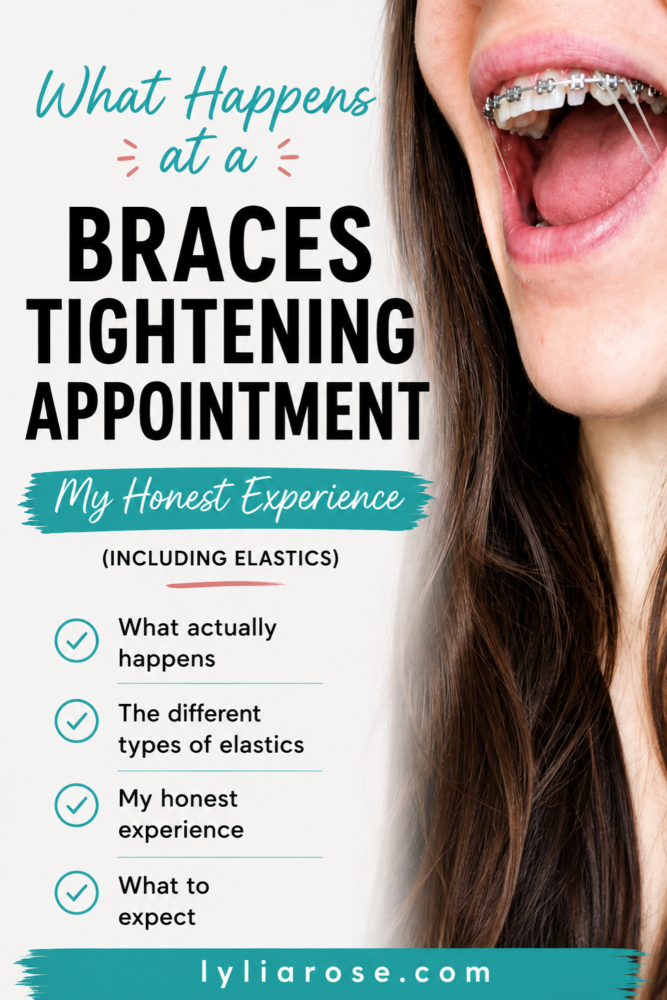Braces Tightening Appointments What to Expect With Elastics Braces Tightening Appointments What to Expect With Elastics