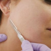 Dermaplaning Online Course (CPD Accredited)