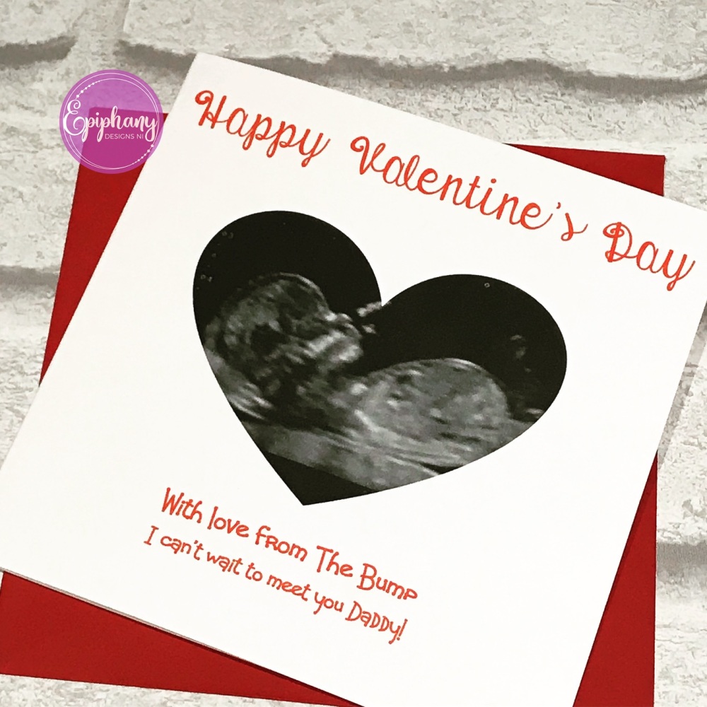 Valentines Day Card with scan photo from the bump