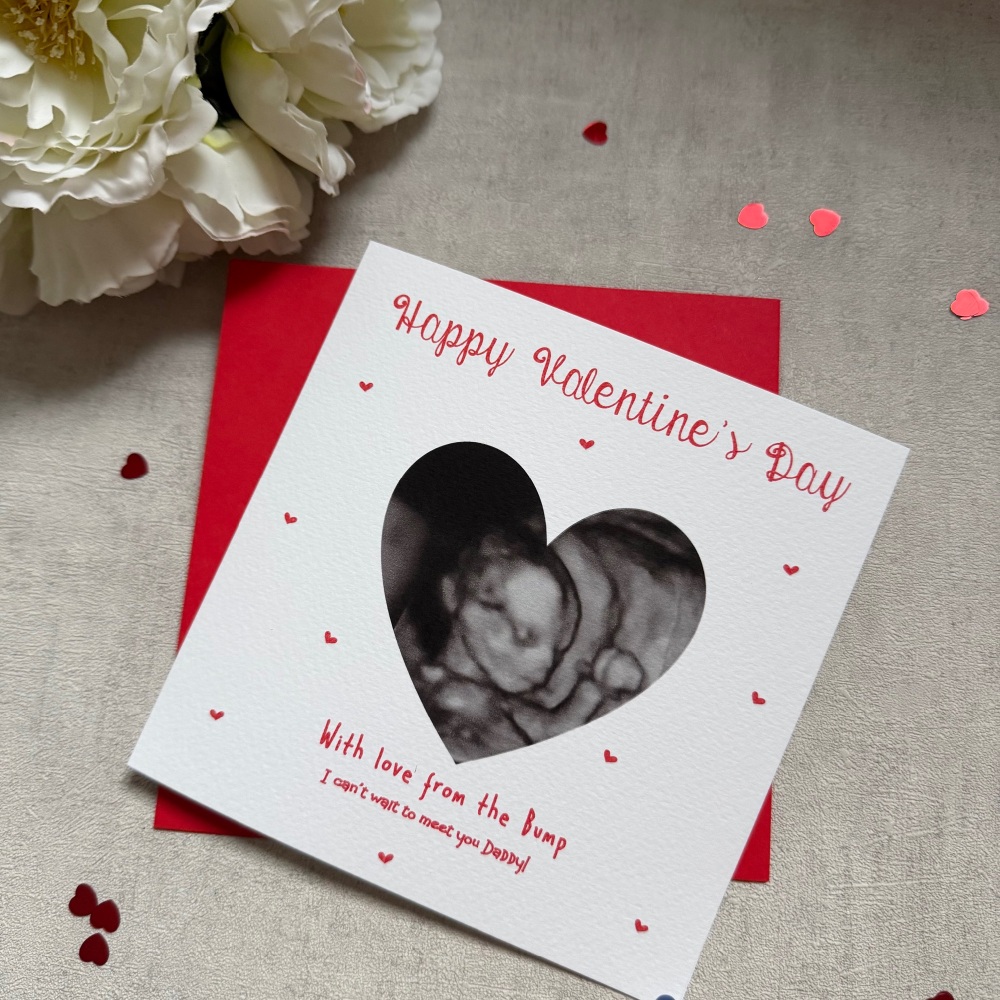 Valentines Day Card with scan photo from the bump