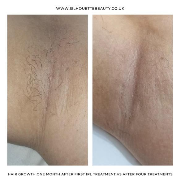 428411597_909563107499125_1913709344661385473_n