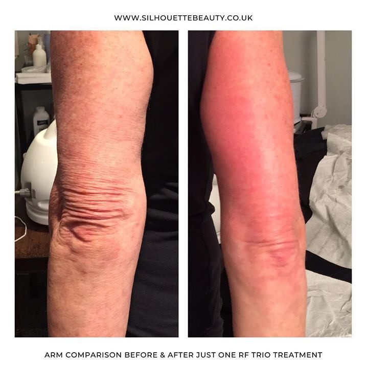 462557702_451718917373065_2569914169626489570_n