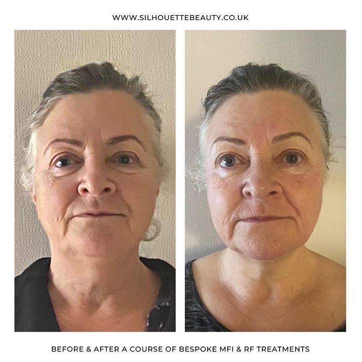 462546437_1649892855568349_3999841970382831759_n