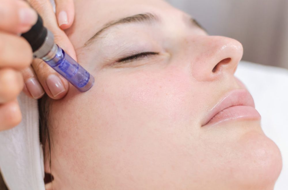 Microneedling/Collagen Induction Therapy