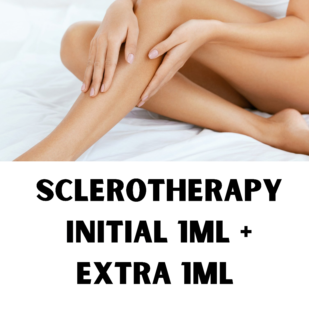 Sclerotherapy (Initial 1ml plus extra 1ml)
