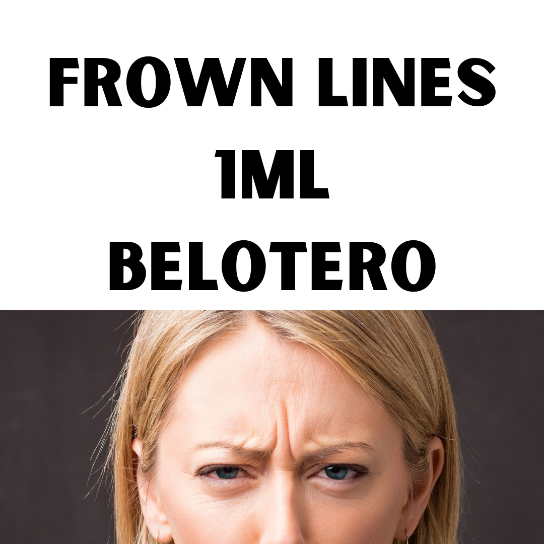 Frown Lines. Belotero 1ml
