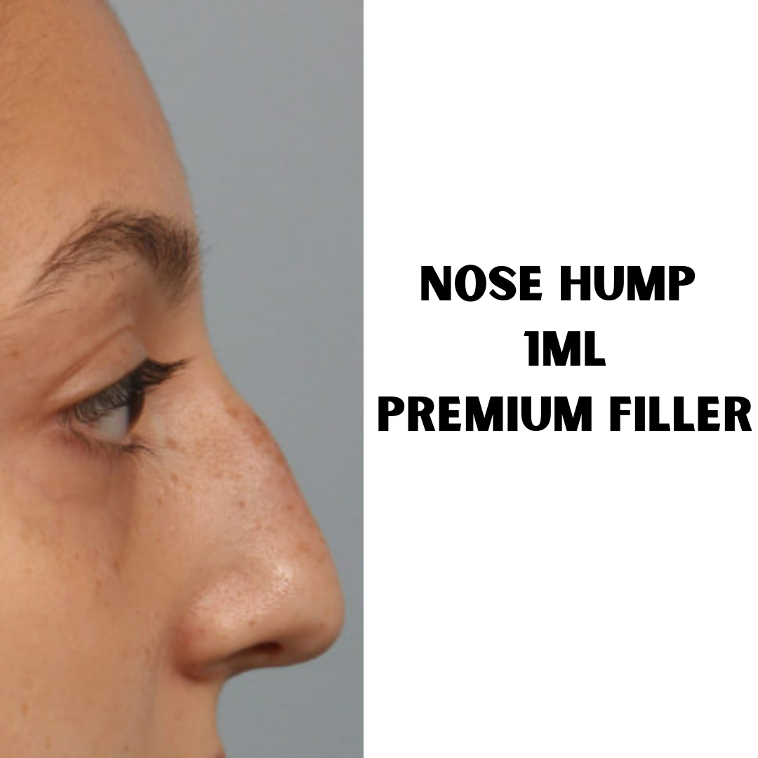 Nose Hump Filler. Premium 1ml