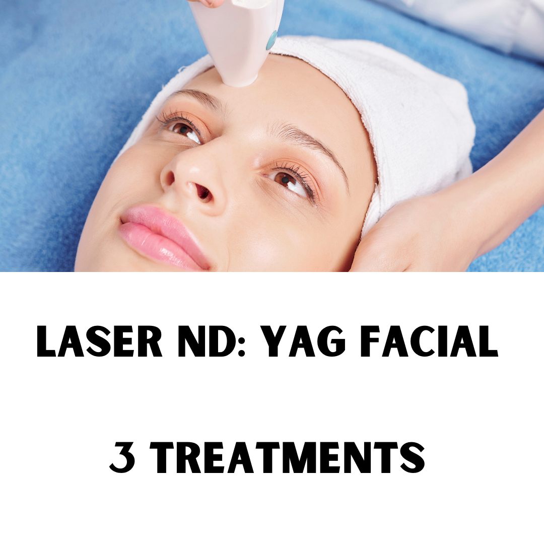 Laser Nd: Yag Facial x 3