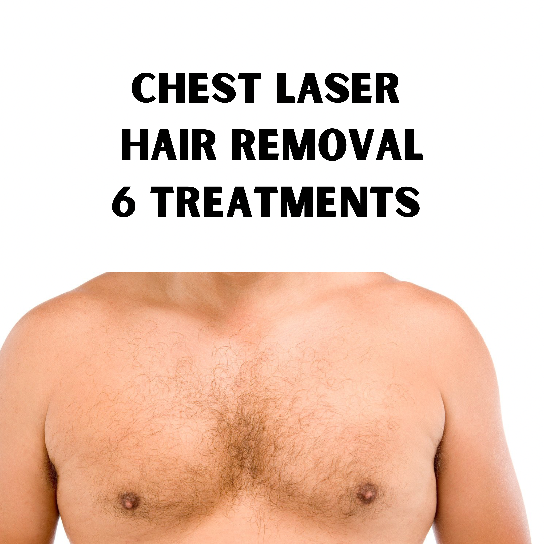 Chest Hair removal (6 treatments)