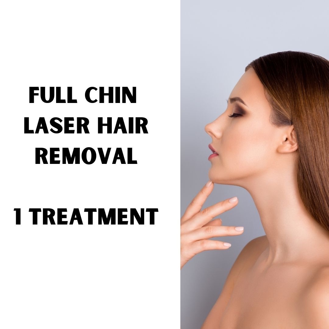 Full Chin Hair removal (1 treatment)