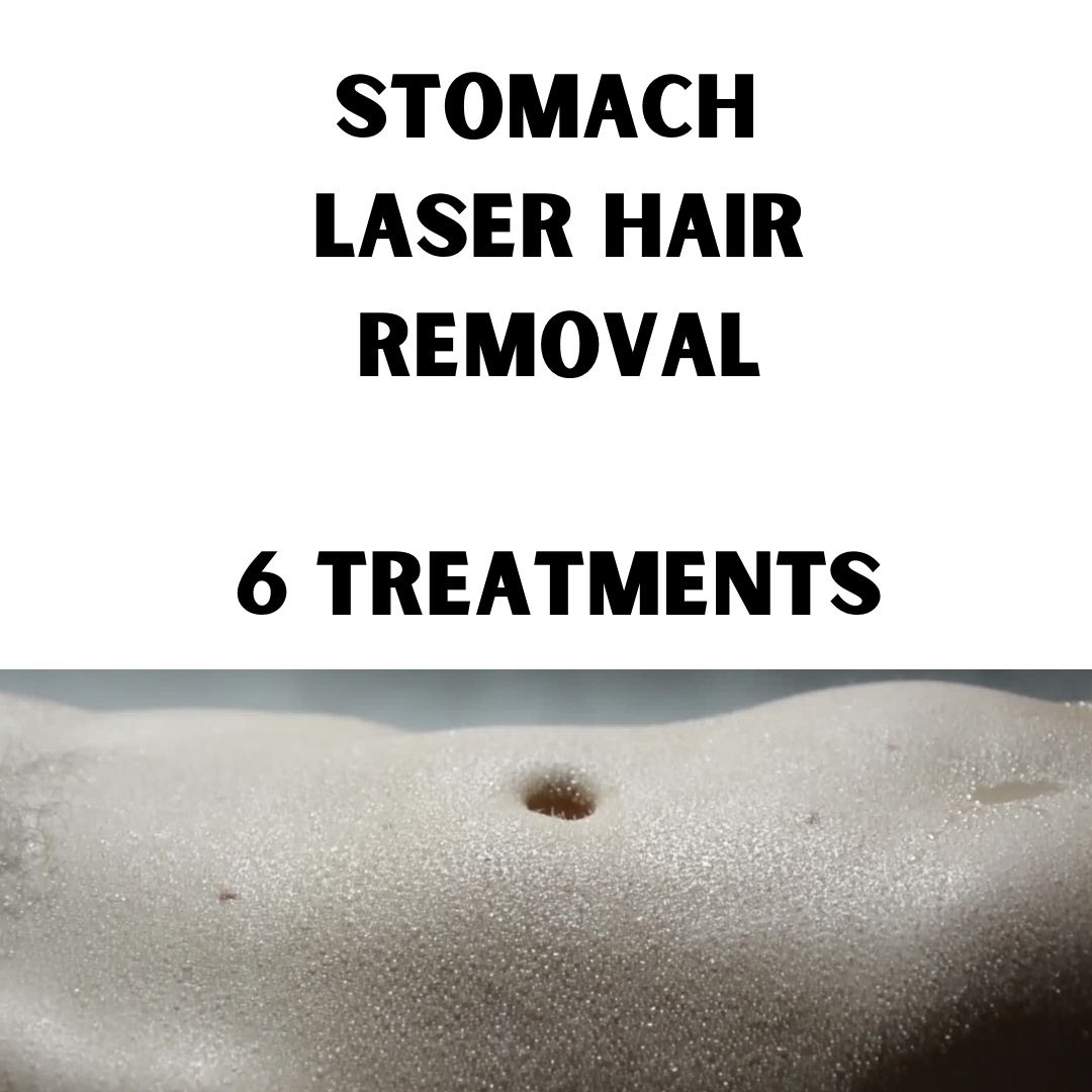 Stomach Hair removal (6 treatments)