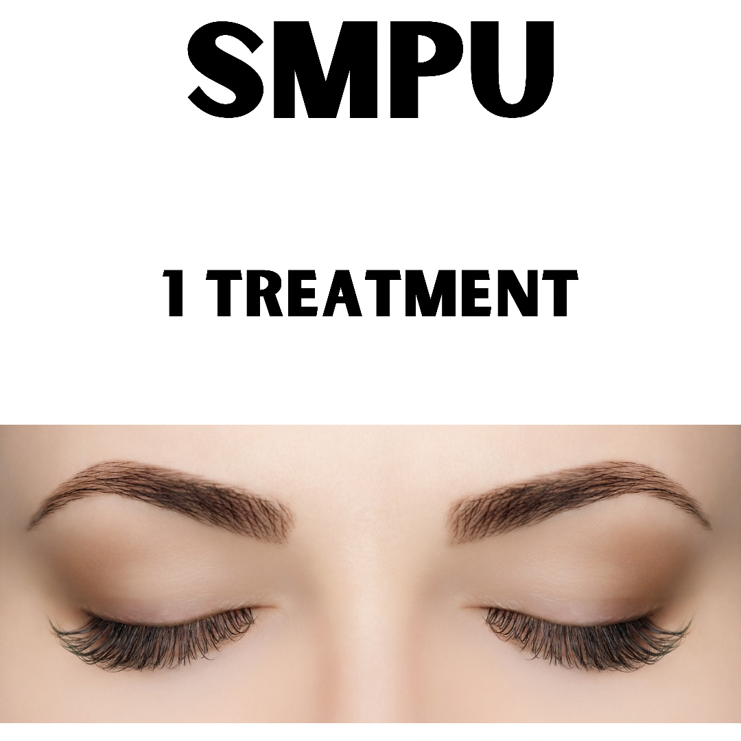 SMPU Laser Tattoo Removal (1 x Treatment)