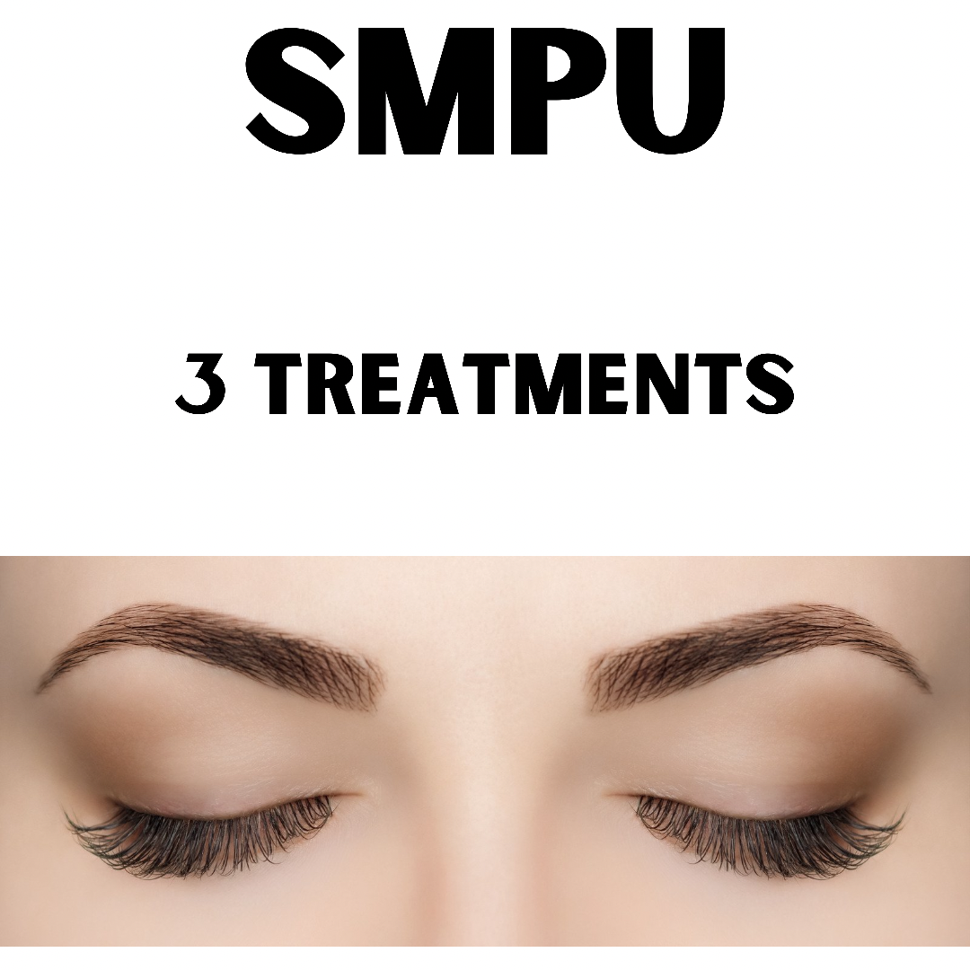 SMPU Laser Tattoo Removal (3 x Treatments)