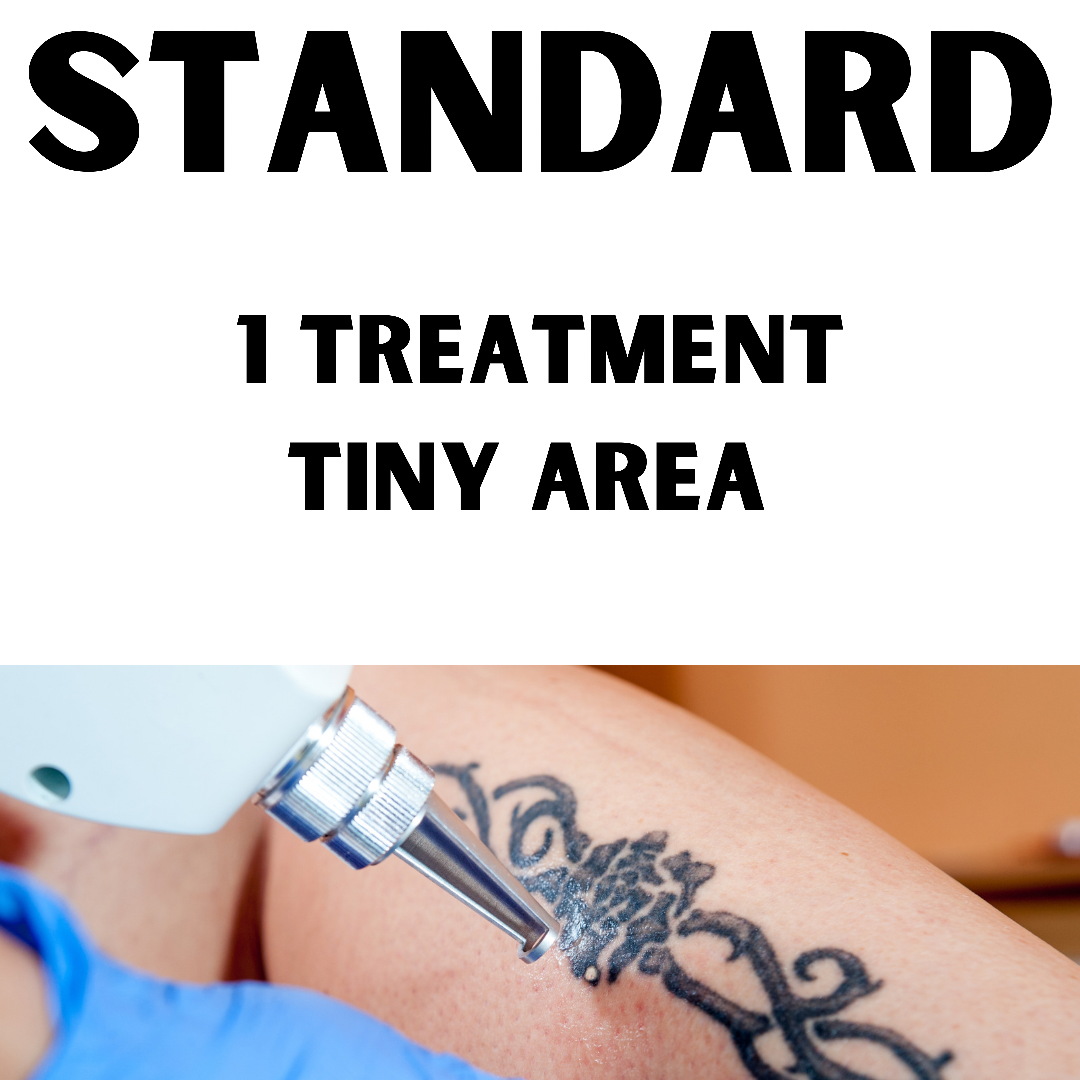 Standard Laser Tattoo Removal (1 Treatment tiny area, 3 x 3cm)