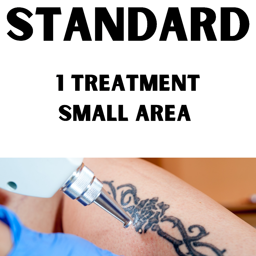 Standard Laser Tattoo Removal (1 x Treatment small area, 6 x 6 cm)