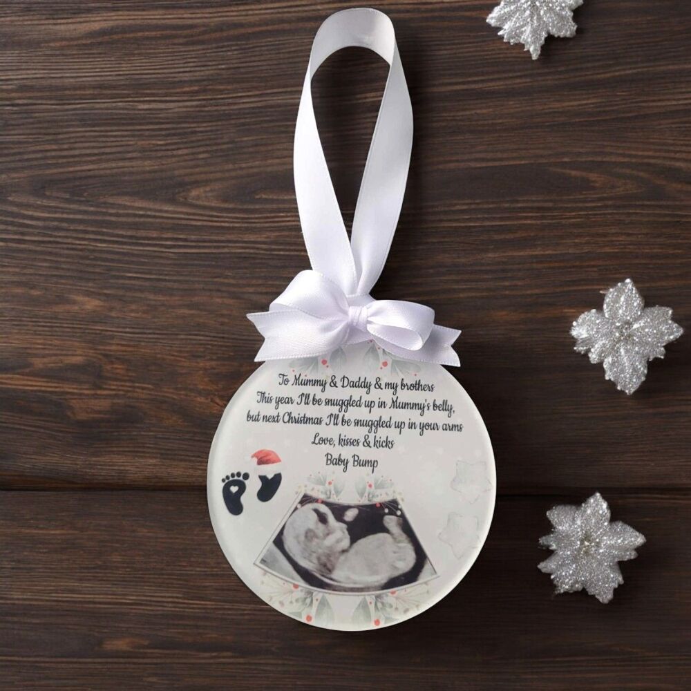 Baby Scan Photo Acrylic Christmas Tree Bauble Keepsake