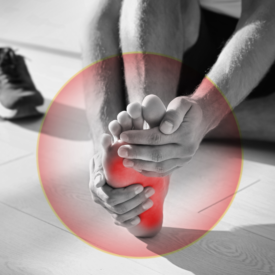 sportif54 sports injury treatment for plantar fasciitis