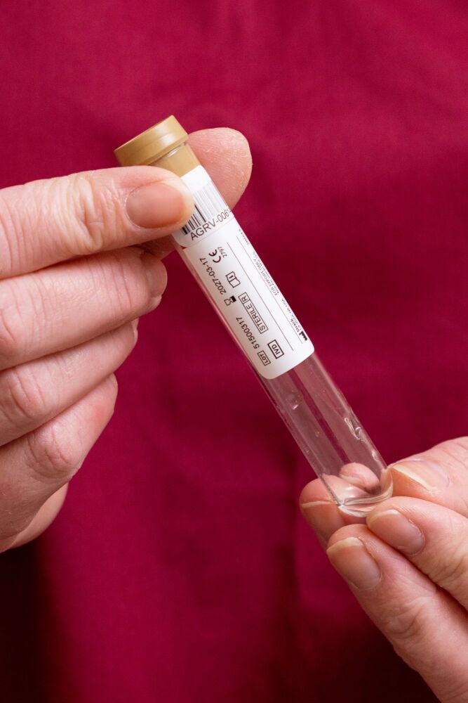 Early Gender Reveal Blood Test (collection at home more than 20 miles from Stratford upon Avon)